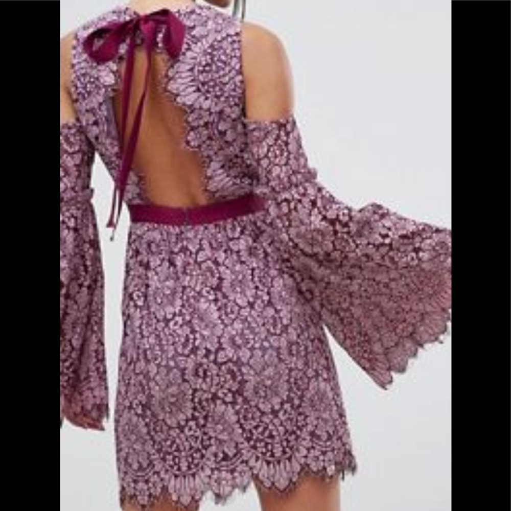 Lace dress!